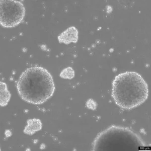B-LCL-HROC112 Cells