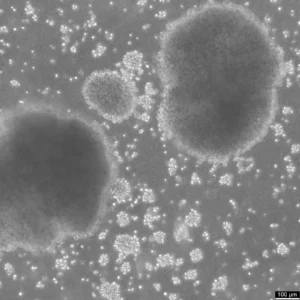 B-LCL-HROC69 Cells