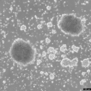 B-LCL-HROC72 Cells