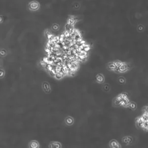 B-LCL-HROC10 Cells