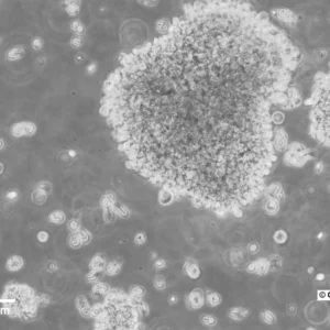 B-LCL-HROC102 Cells