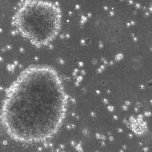 B-LCL-HROC103 Cells