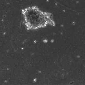 B-LCL-HROC117 (Bc HROC117) Cells