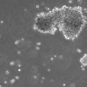 B-LCL-HROC130 Cells
