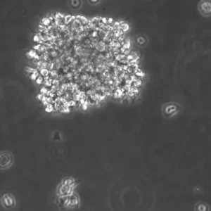 B-LCL-HROC195 Cells