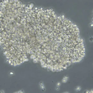 B-LCL-HROC24 Cells