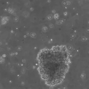 B-LCL-HROC32 (Bc HROC32) Cells