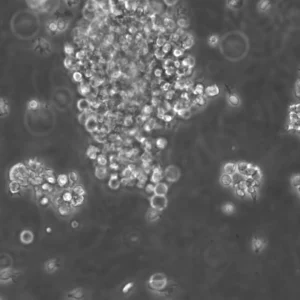 B-LCL-HROC43 Cells