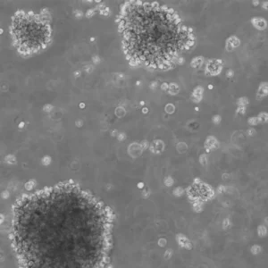 B-LCL-HROC60 Cells