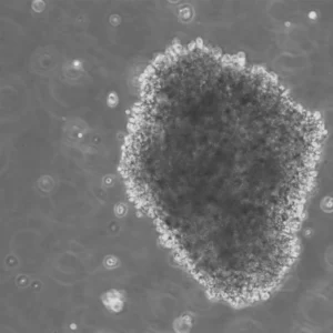 B-LCL-HROC75 Cells