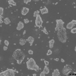 HROC147Met Cells