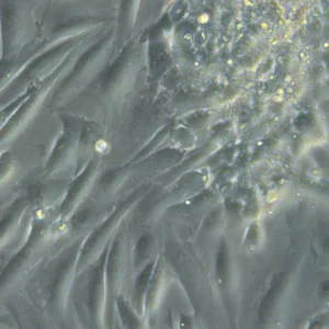HROG17 T1 M1 Cells
