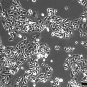 PM-LGSOC-01 Cells