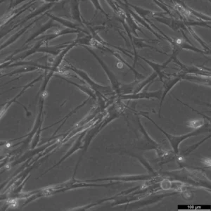 Wilms10M Cells