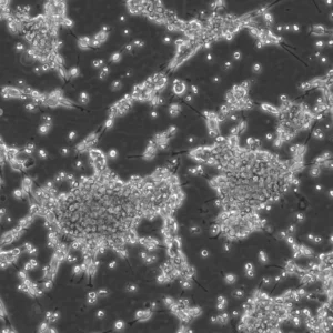 AT-1 Cells