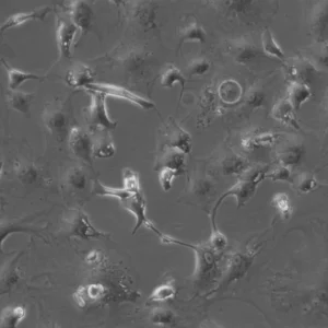 HBL-52 Cells