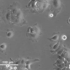 HNO210 Cells