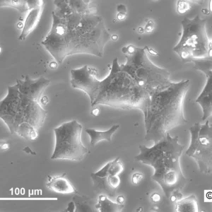 HNO258 Cells