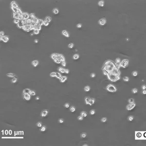 HROC107 Cells