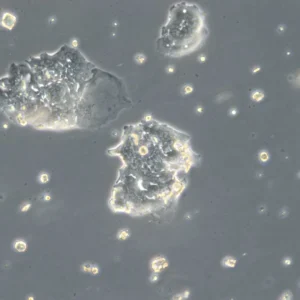 HROC126 Cells