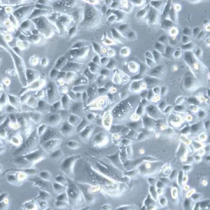 HROC173 Cells