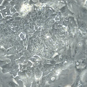 HROC18 Cells
