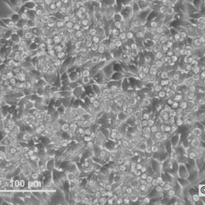 HROC24 T1 M1 Cells