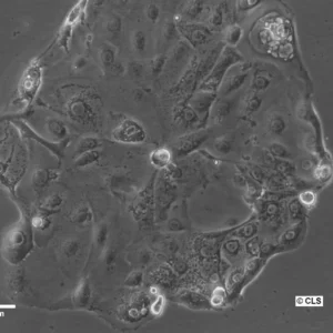 HROC277Met2 Cells