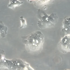 HROC284Met Cells