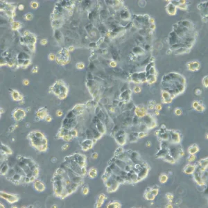HROC285 T0 M2 Cells