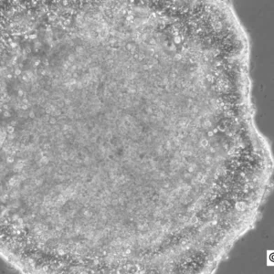 HROC296 Cells