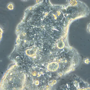 HROC309 Cells