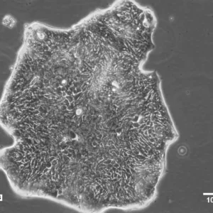 HROC32 Cells
