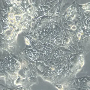 HROC32 T3 M1 Cells