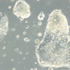 HROC357 Cells