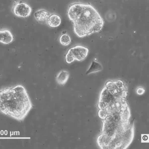 HROC374 Cells