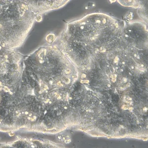 HROC39 Cells
