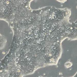 HROC40 Cells
