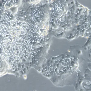 HROC43 Cells