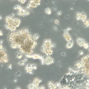 HROC59 T1 M1 Cells