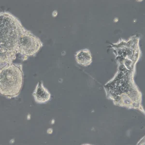 HROC69 T0 M2 Cells