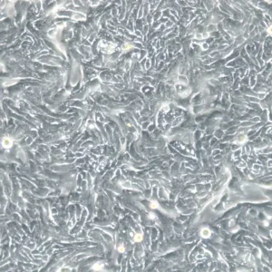 HROC80 T1 M1 Cells