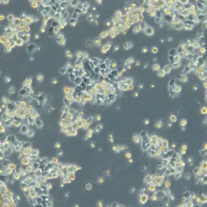 HROC87 T0 M2 Cells