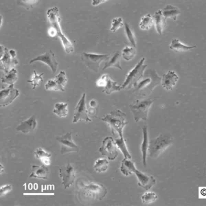 HROG17 Cells