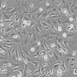 HROG36 Cells