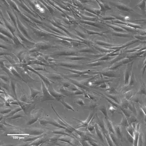 imWilms1 Cells