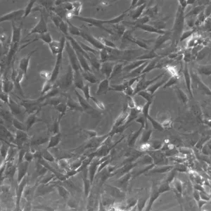ImWilms10T Cells