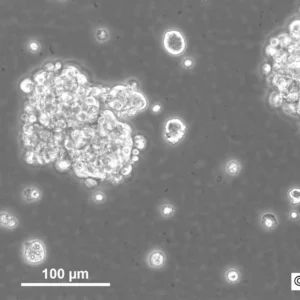 NCH421K Cells