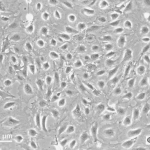 SVI Cells
