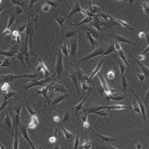 Wilms10T Cells